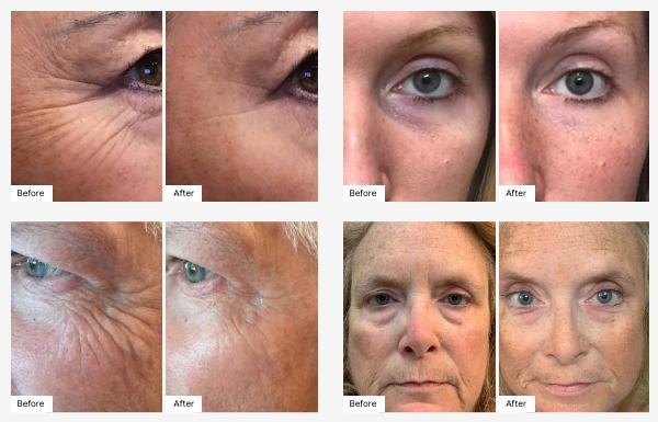 10 images of actual customers' Before & After photos displaying their Real Results with Eye Serum. 